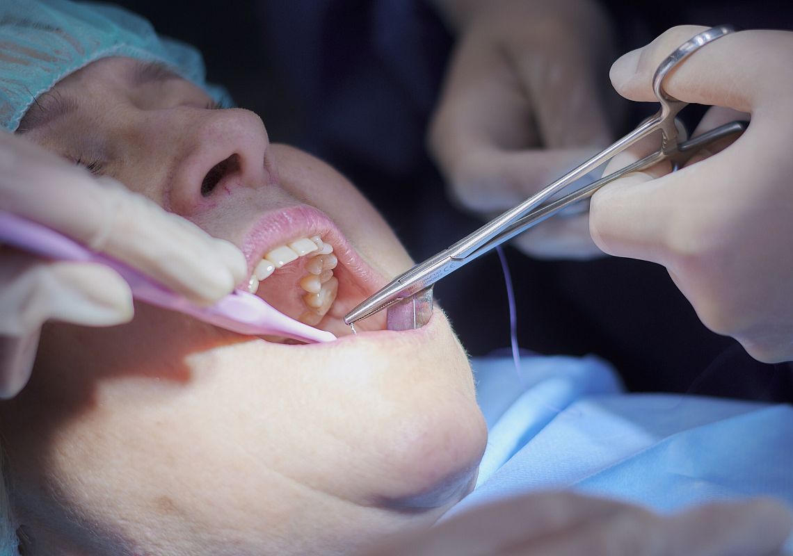 Chirurgia stomatologiczna i implantologiczna w przychodni SALUS, Sobieskiego 30